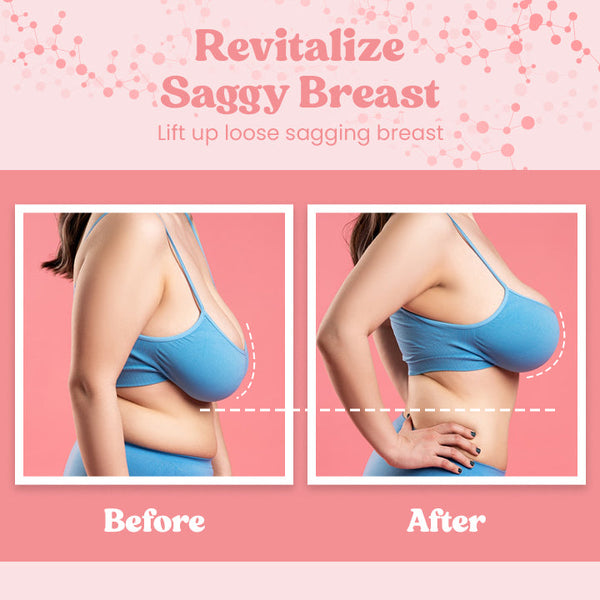 Revitalize-Saggy-Breast