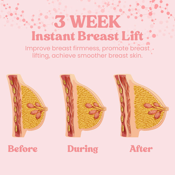 Week-Lift